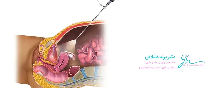 بهترین جراح لاپاراسکوپی تهران