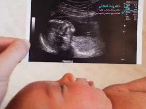 سونوگرافی آنومالی